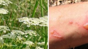 Attenzione: questa pianta ornamentale provoca ustioni e può accecare