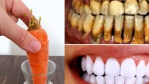 Denti più bianchi grazie alle carote: come avere un sorriso smagliante in pochi passaggi