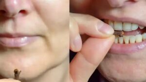 Mastica i chiodi di garofano ogni giorno: gli effetti benefici sono inaspettati