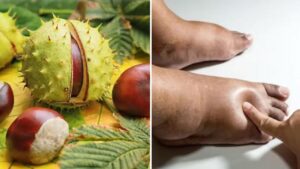 Il segreto naturale per gambe leggere: scopri i benefici dell’ippocastano